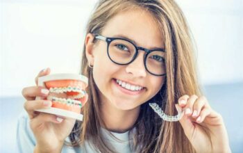 The Benefits of Invisalign Over Traditional Braces